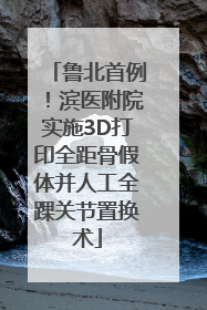 鲁北首例！滨医附院实施3D打印全距骨假体并人工全踝关节置换术